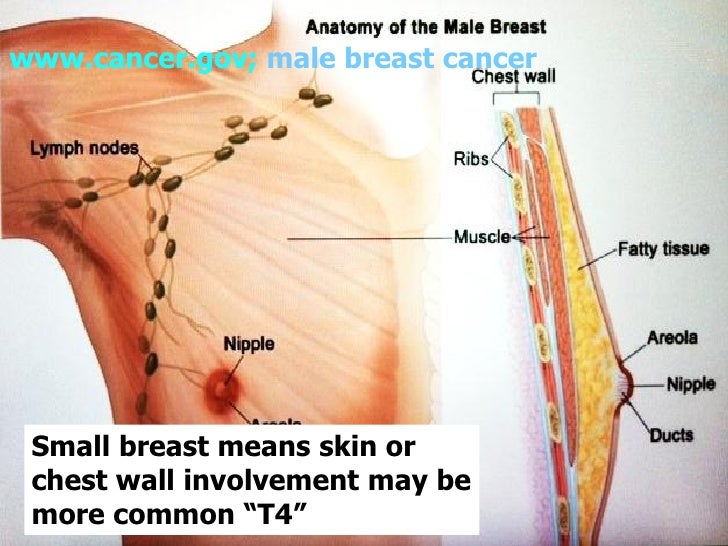 male fibrocystic breast Sex and revealing lingerie